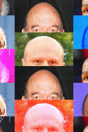 Umursamıyormuş Gibi Görünmekten Daha Havalı Hiçbir Şey Yok: Saçlarını Kaybettiğini Kabullenmek