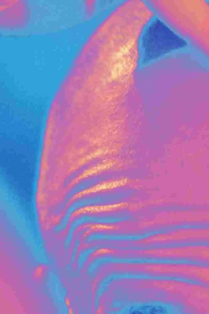 Bir Uzmana Göre Kolajen Bantları Alın Kırışıklıklarını Yok Edebilir mi?