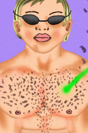 Erkekler İçin Lazer Epilasyon: 101