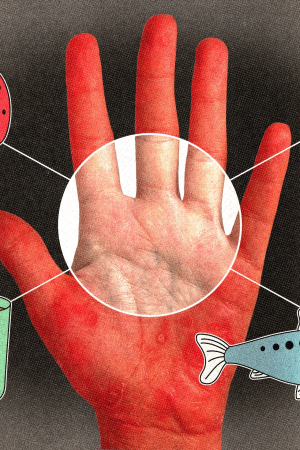 Sedef Hastalığını Hafifletmek İçin Ne Yemeli (ve Nelerden Kaçınmalı), Uzmanlar Anlatıyor