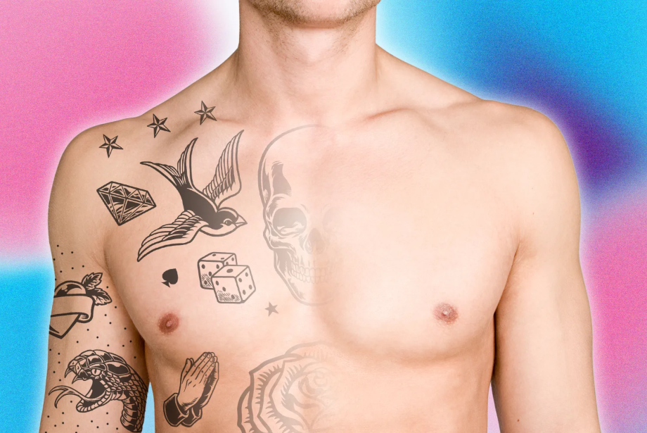 Bişektomi İle İlgili Bilmeniz Gereken Her Şey