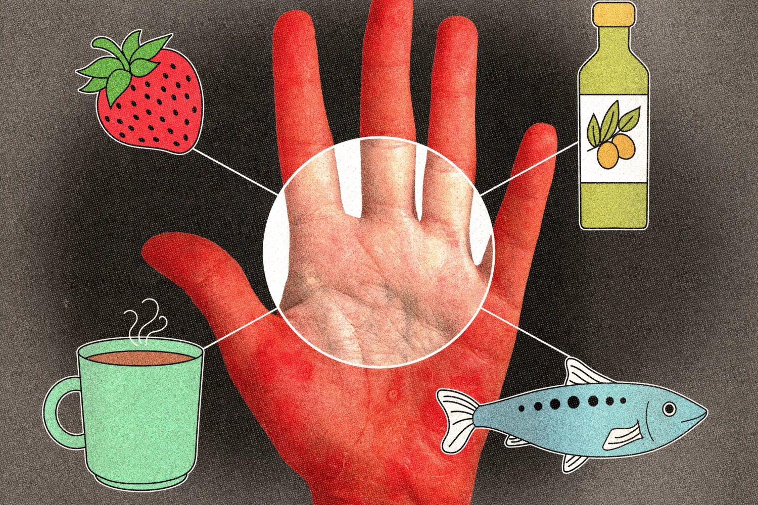 Sedef Hastalığını Hafifletmek İçin Ne Yemeli (ve Nelerden Kaçınmalı), Uzmanlar Anlatıyor