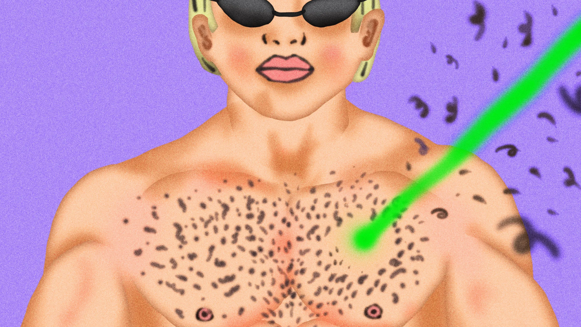 Erkekler İçin Lazer Epilasyon: 101