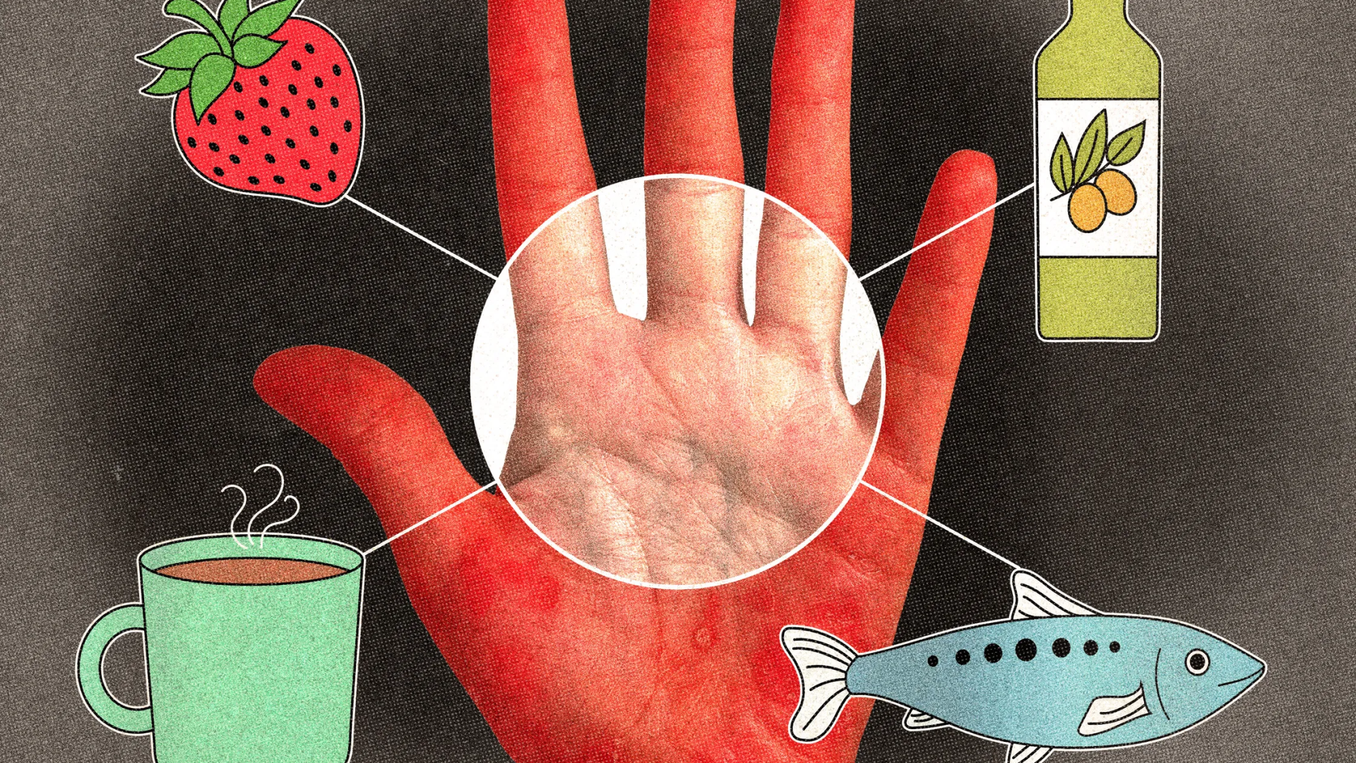 Sedef Hastalığını Hafifletmek İçin Ne Yemeli (ve Nelerden Kaçınmalı), Uzmanlar Anlatıyor